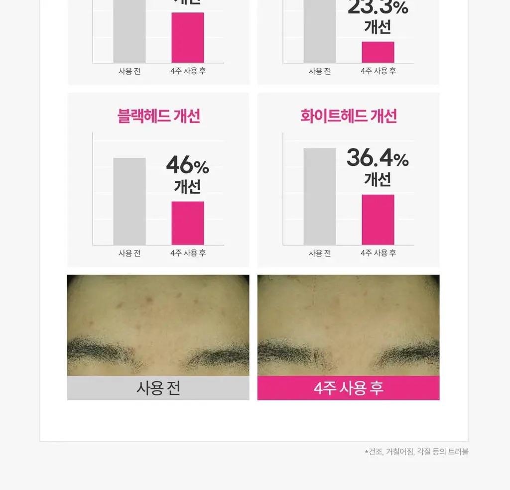 [응급진정/트러블케어] 로벡틴 시카케어 블레미쉬 클리어링 크림 50ml 리필기획 (+리필 40ml) 상세페이지 12